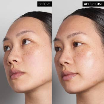 model's before and after using the serum to help make skin appear more glowy and hydrated 