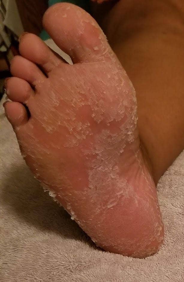 Close-up of a person's foot needing moisturizing, indicating products that treat dry skin could be discussed
