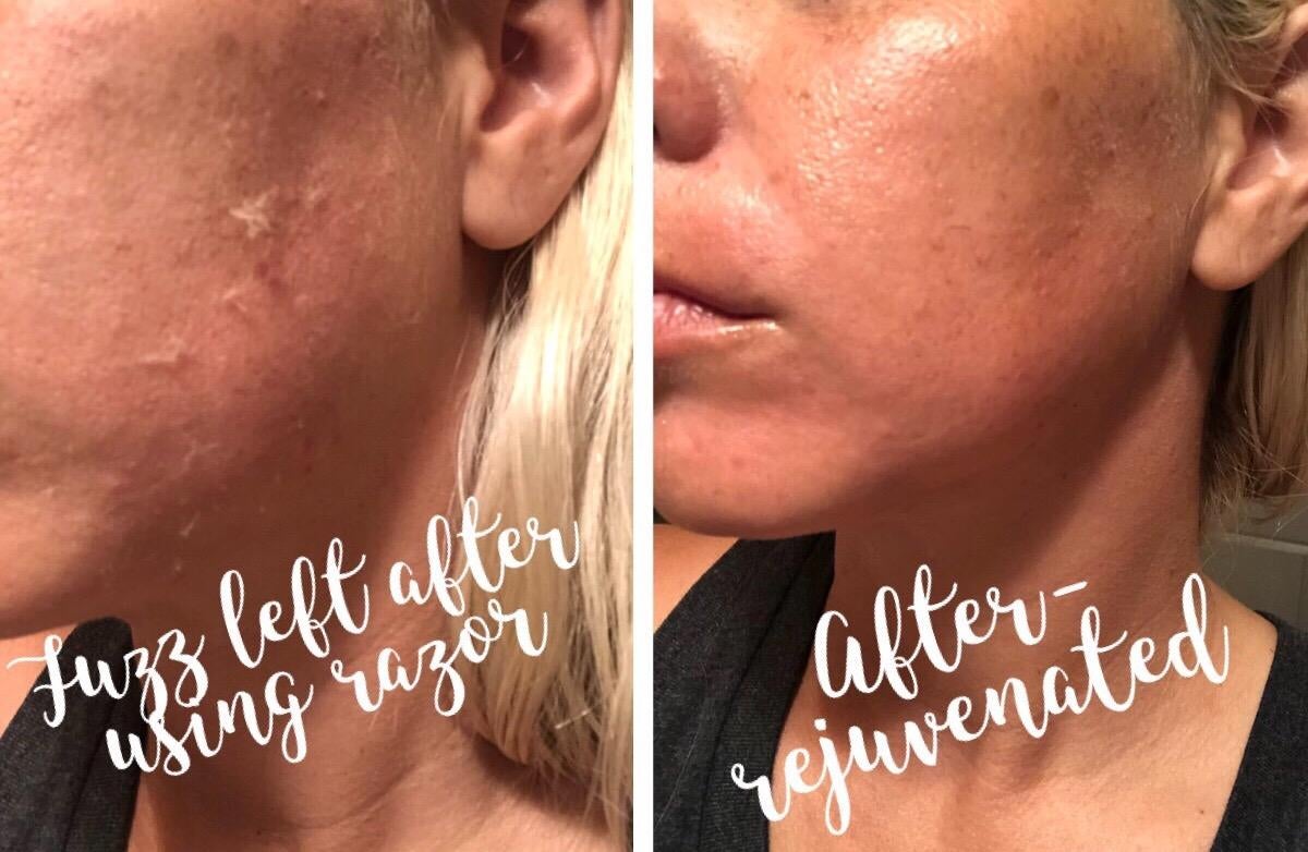 before photo of a reviewer with noticeable peach fuzz on their face next to an after photo of the reviewer's cheek with the peach fuzz removed