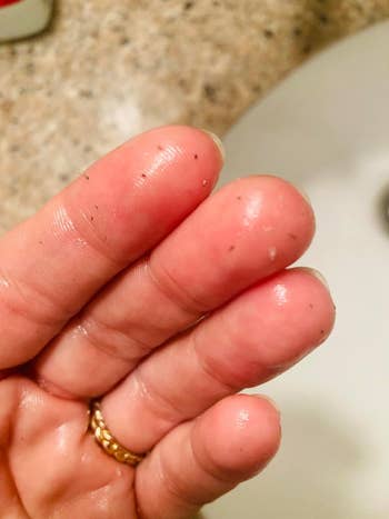 Close-up of a person's fingers showing the sebum that came retired  of the reviewer's pores