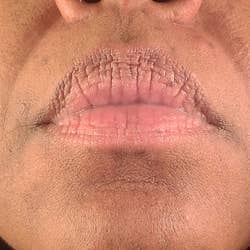 a close-up of the same reviewer's lip with the hair removed 