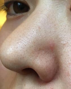 Close-up of a reviewer's nose showing skin texture and acne