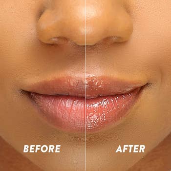 before-and-after of the model wearing the lip sleeping mask (right) and the model's chapped lips before using the mask (left)