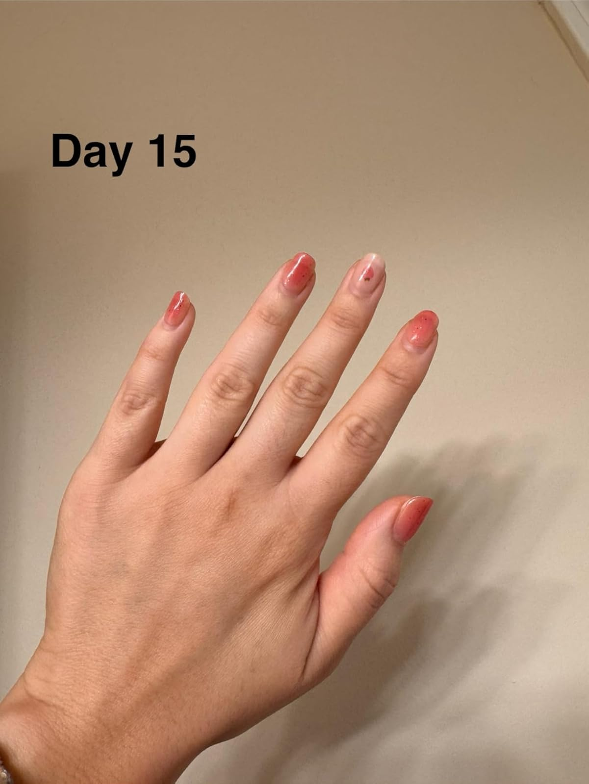 Hand with chipped nail polish connected  Day 15, showing nail maturation  and wear