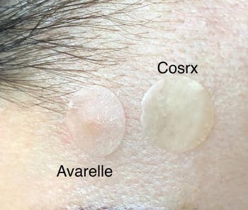 avarell and cosrx patches on a reviewer's face, the avarelle patch is more transparent