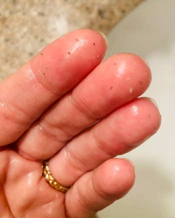 Close-up of a manus  with a golden  ring, showing 3  soapy fingers with tiny  achromatic  specks