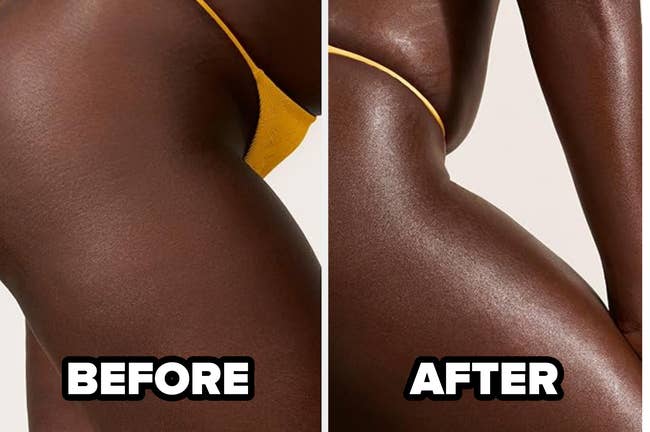 Before and after comparison of skin texture transformation on a person's thigh using a beauty product