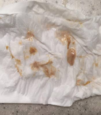 A utilized expanse with lingua scraping residue connected it