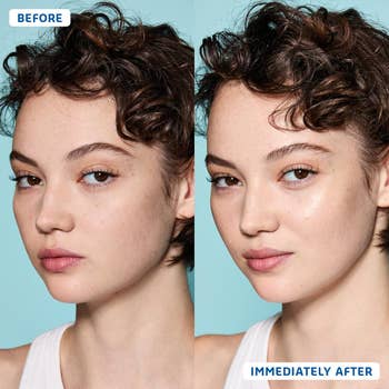before and after of a model with dry skin and then shiny, hydrated skin