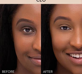 a before and after of a model no longer with dark circle around their eyes