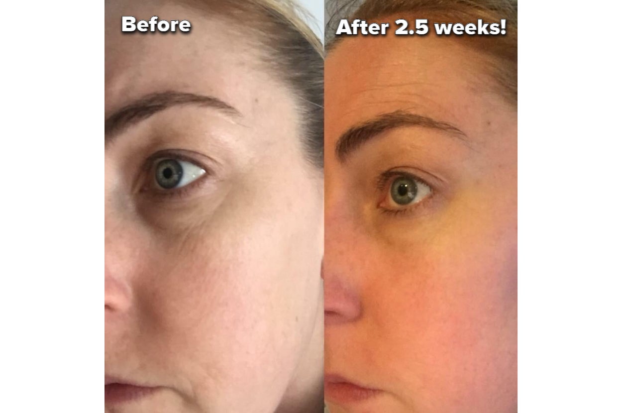 25 Best Eye Creams That Make Dark Circles Go Bye Bye