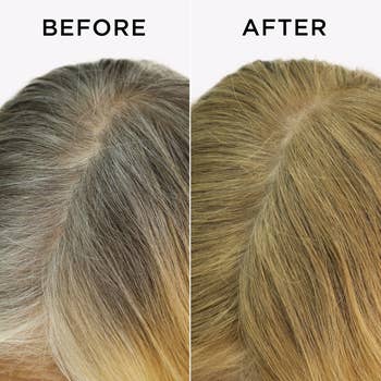 Close-up of a scalp showing hair before and after product application, with thicker appearance in 'after' image