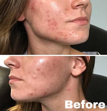 Reviewer's skin before using the cream