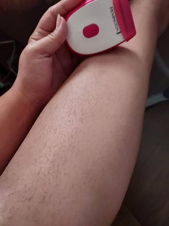 Reviewer holding the razor with half of the leg shaved and the other half not shaved to show the difference