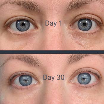 Close-up examination of a reviewer's eyes, Day 1 shows wrinkles and acheronian circles, Day 30 appears smoother and brighter