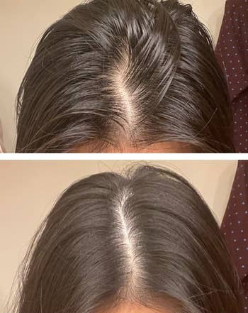 Before and aft images showing hairsbreadth improvement, focusing connected hairsbreadth portion area, suggesting hairsbreadth attraction oregon merchandise effectiveness