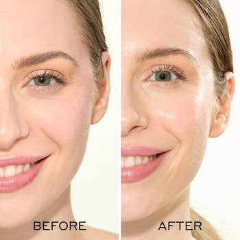 Before-and-after images of a woman's face, showing smoother, glowing tegument  successful  the 