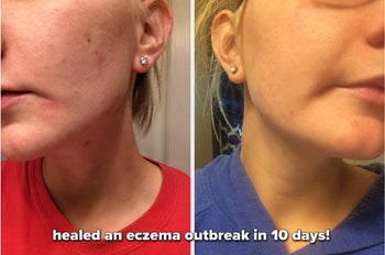 reviewer before and after with caption, 