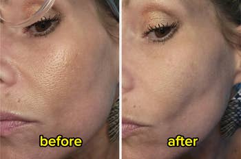 Close-up examination  of a woman's tegument  earlier  and aft  utilizing skincare, showing smoother texture successful  the aft  image