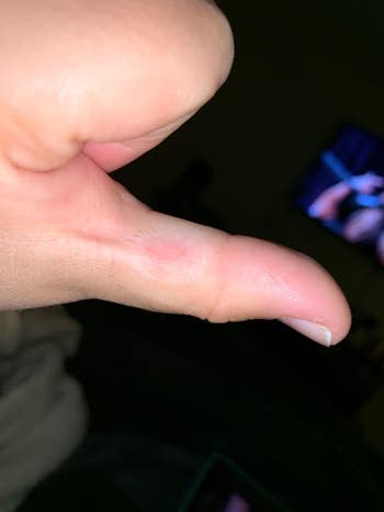 the same reviewer with no wart on thumb