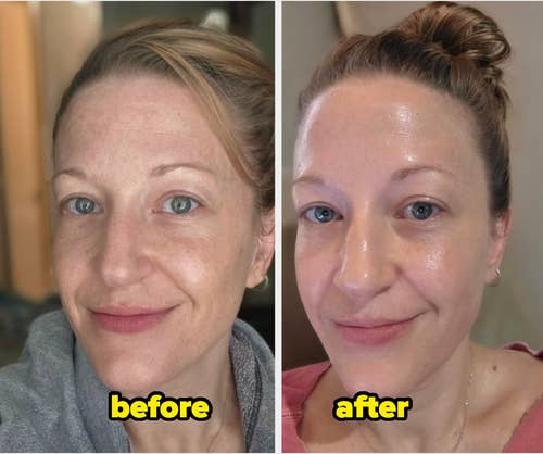 Side-by-side comparison showing a woman's face before and after using a skincare product, highlighting improved skin appearance