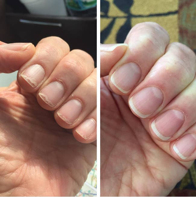 Reviewer with peeling, weak nails before using the oil and with strong-looking nails after using the oil