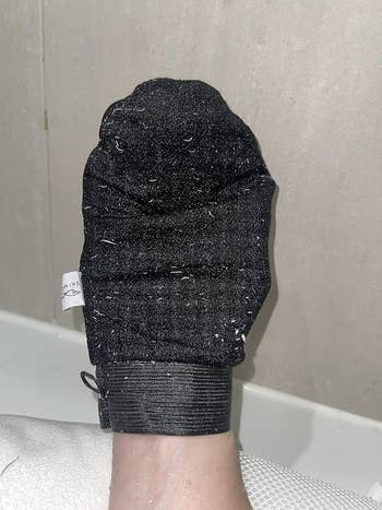 Reviewer's mitt with visible dead skin flakes