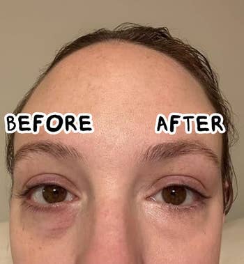 Close-up of a person's eyes showing a