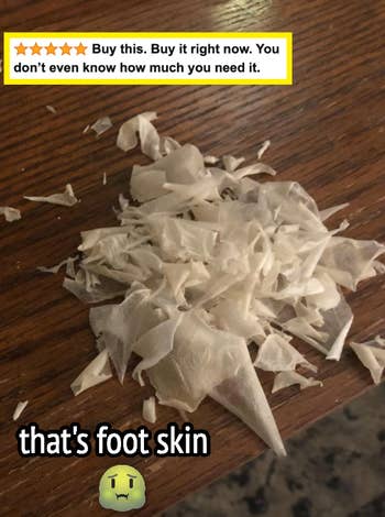 a reviewer's pile of skin that came off their foot 