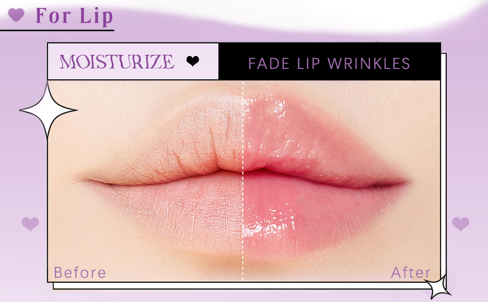  Before and After treatment, with reduced wrinkles and enhanced smoothness