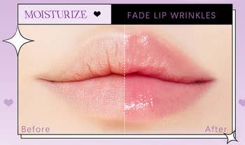 Before and After treatment, with reduced wrinkles and enhanced smoothness