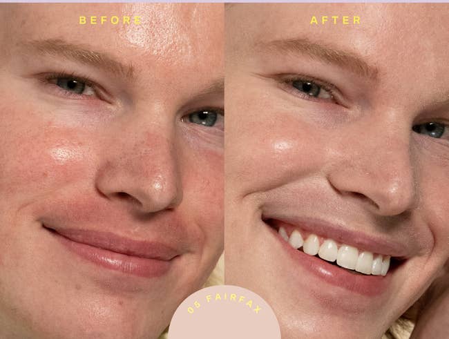before and after of a model without and then with the tinted sunscreen on their face (in the shade 