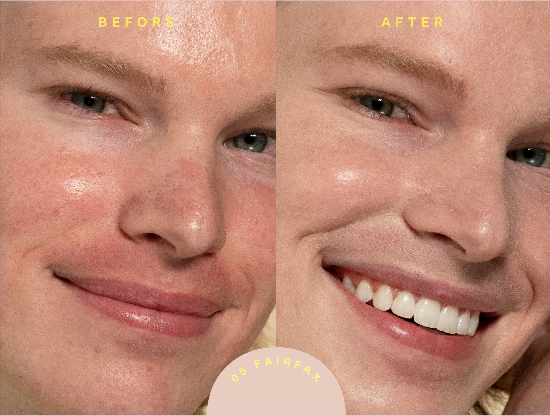 before and after of a model without and then with the tinted sunscreen on their face (in the shade 