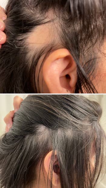 reviewer shows two close-up images of scalp with hair loss patches, then regrowth and fuller hair after using oil