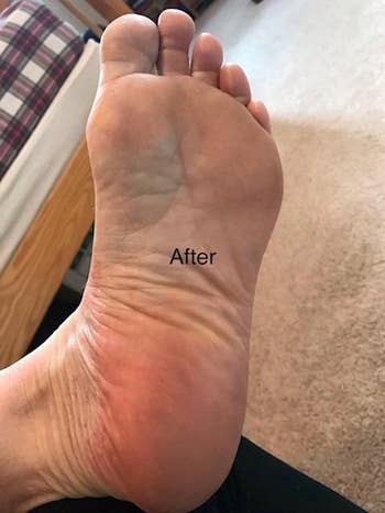 Reviewer's foot after using foot soak