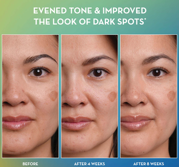 before and after of a model who used the toner for 8 weeks