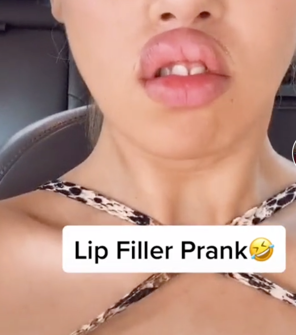 Sale > tiktok lip filler prank > in stock