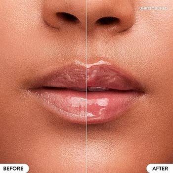 Close-up examination of lips earlier and aft utilizing the articulator balm
