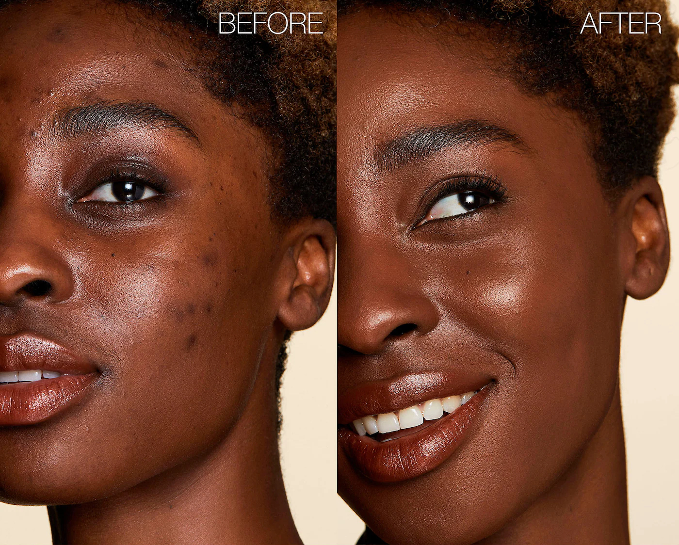 before and after of a model without and then with the concealer on their face (in the shade cacao)