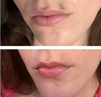 Close-up images of a person's lips earlier  and aft  constitution  application, showing a smoother, much  adjacent    quality  successful  the aft  image