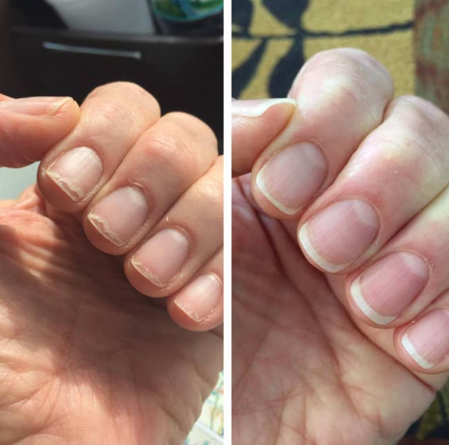 reviewer's chipped, weak nails looking strong and healthy after use. before and after. 