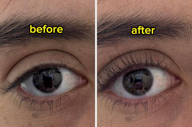 Close-up examination  of eyes, labeled 