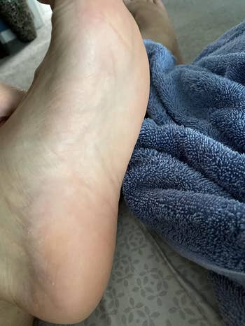 reviewer's foot looking smooth 
