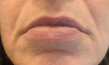 A reviewer wearing the lip balm