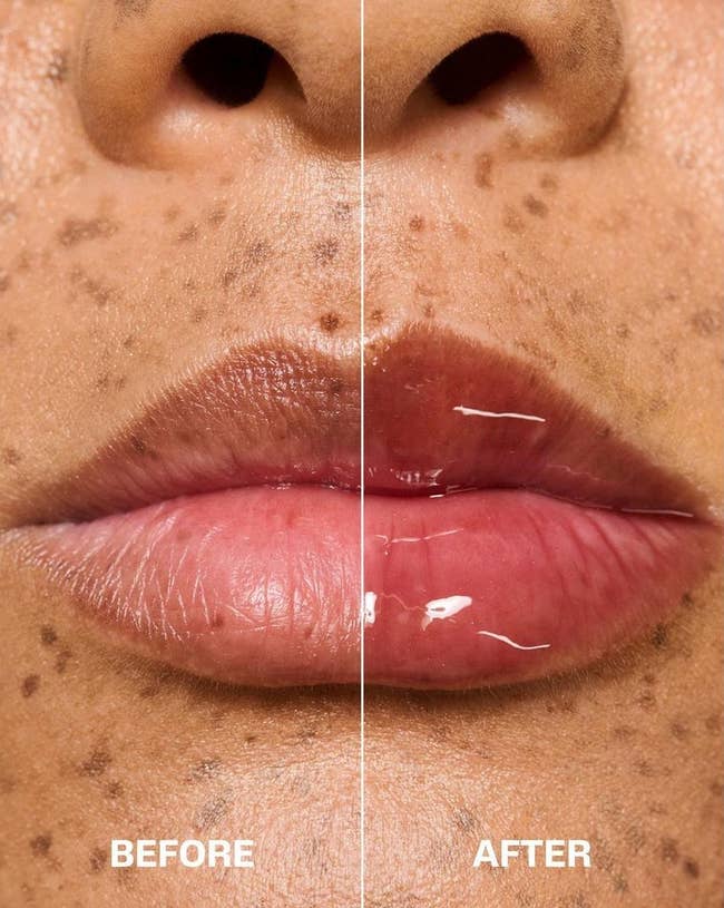 Tampilan jarak dekat dari bibir dibagi menjadi dua bagian; sisi kiri diberi label