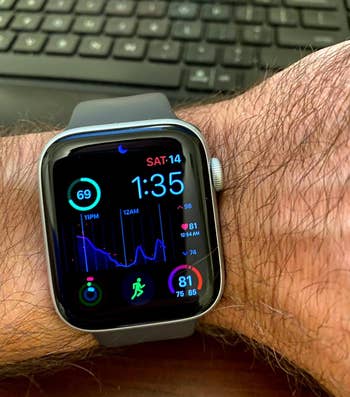 a reviewer photo of someone wearing the apple watch to show sleep tracking