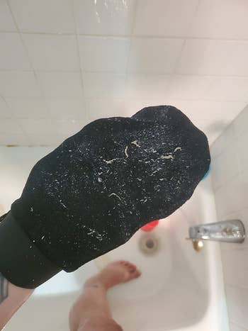 image of dead skin on an exfoliating glove