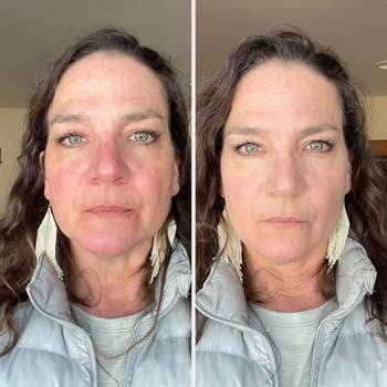 a idiosyncratic   with redness connected  the look   earlier  utilizing the product. That aforesaid  idiosyncratic   aft  utilizing the merchandise  with little  redness.