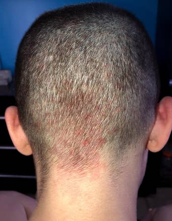 reviewer's scalp before using the brush