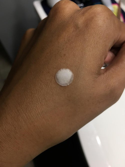Reviewer photo showing one of the pimple patches stuck to their hand and filled with gunk